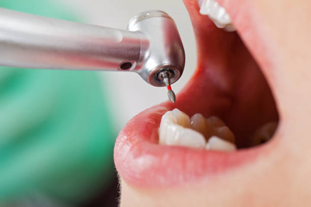 Best Emergency Broken Tooth Repair in West Richland, WA